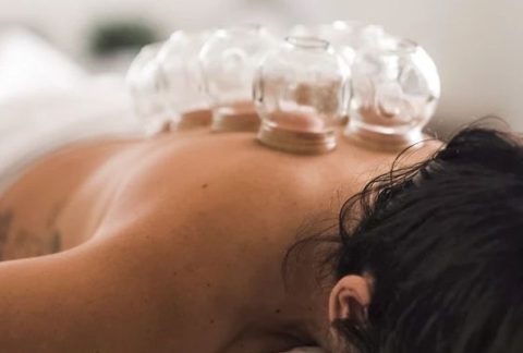 Cupping